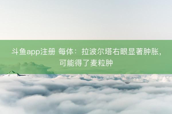 斗鱼app注册 每体：拉波尔塔右眼显著肿胀，可能得了麦粒肿